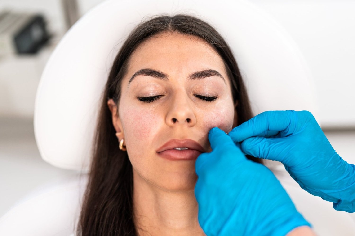 Skin booster treatment